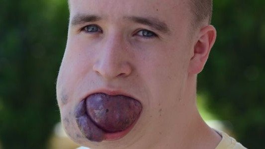 Festyn dla Krzysztofa Węgrzyna