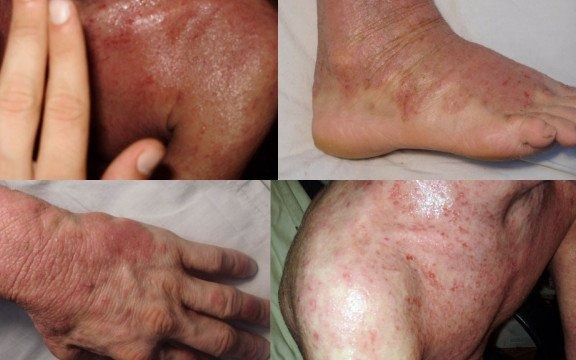 Ulżyj cierpieniom Szymona