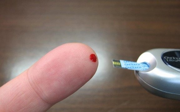 Zbadaj się bezpłatnie w oświęcimskim Ekonomiku