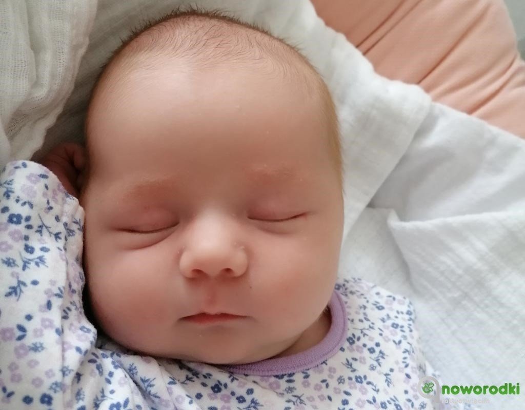 Noworodkowa (zdalna) galeria eFO – FOTO