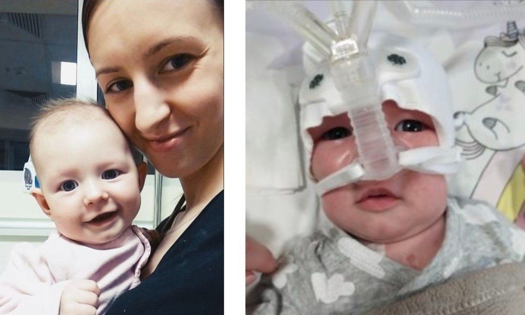 Serduszko małej Milenki wymaga kosztownej operacji