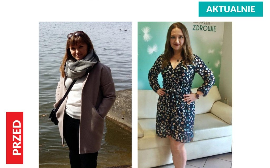 Fenomenalna metamorfoza – Pani Agata schudła 13 kilogramów z Projekt Zdrowie