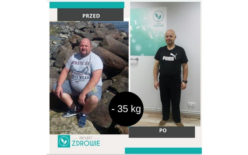 Pan Grzegorz schudł 35 kg z Projekt Zdrowie