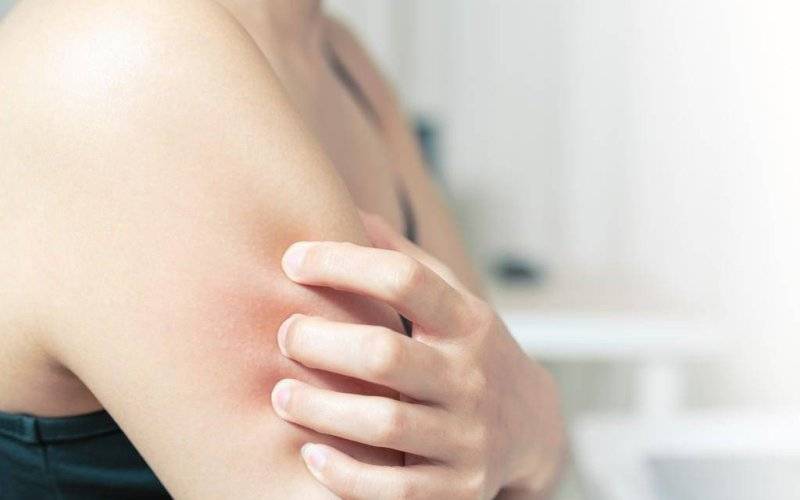 Wysypka alergiczna – jak ją rozpoznać?