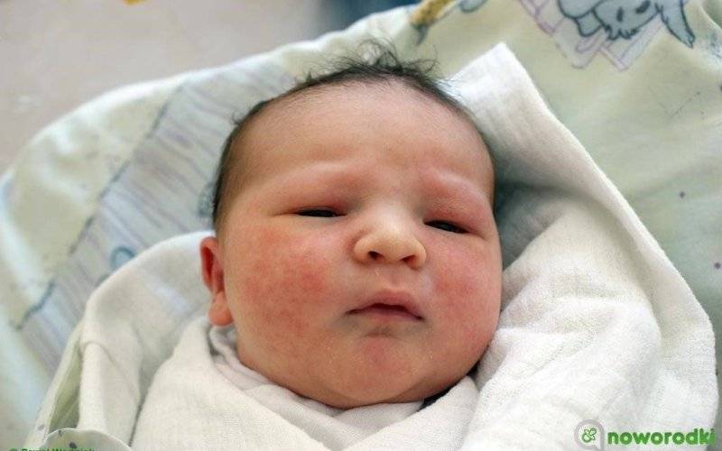 Noworodkowa galeria eFO – FOTO