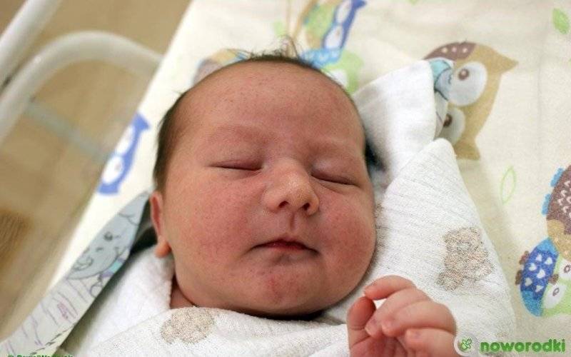 Noworodkowa galeria eFO – FOTO