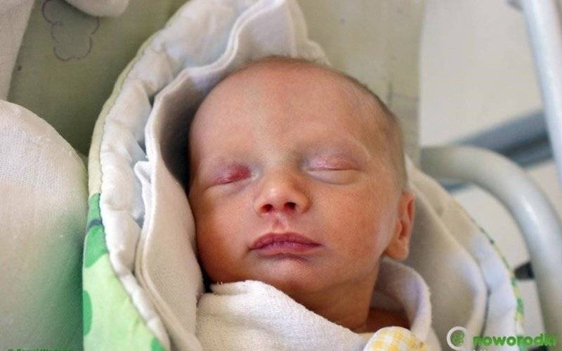 Noworodkowa galeria eFO – FOTO