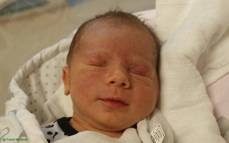 Noworodkowa galeria eFO – FOTO