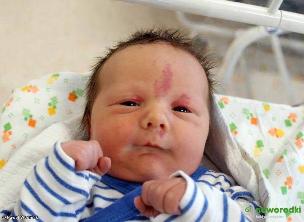 Noworodkowa galeria eFO – FOTO