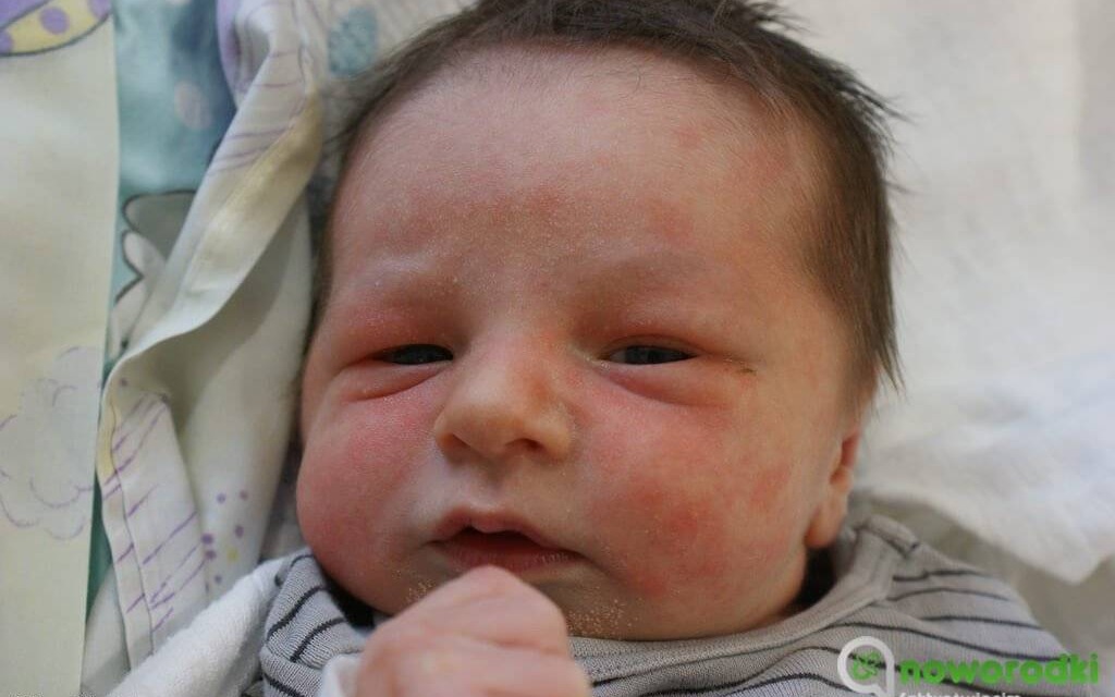 Noworodkowa galeria eFO – FOTO