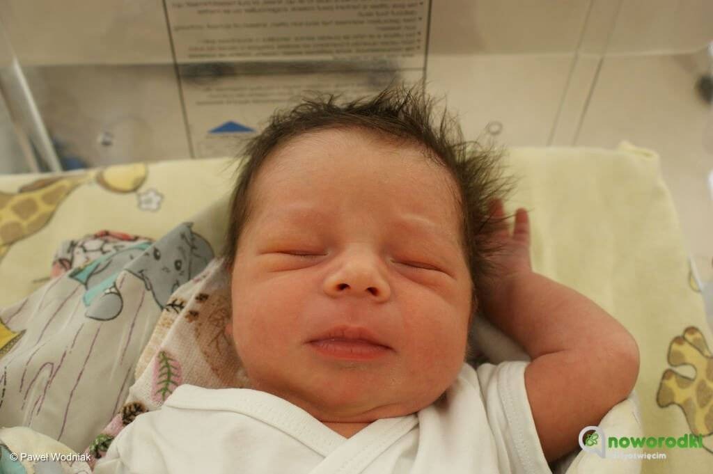 Noworodkowa galeria eFO – FOTO