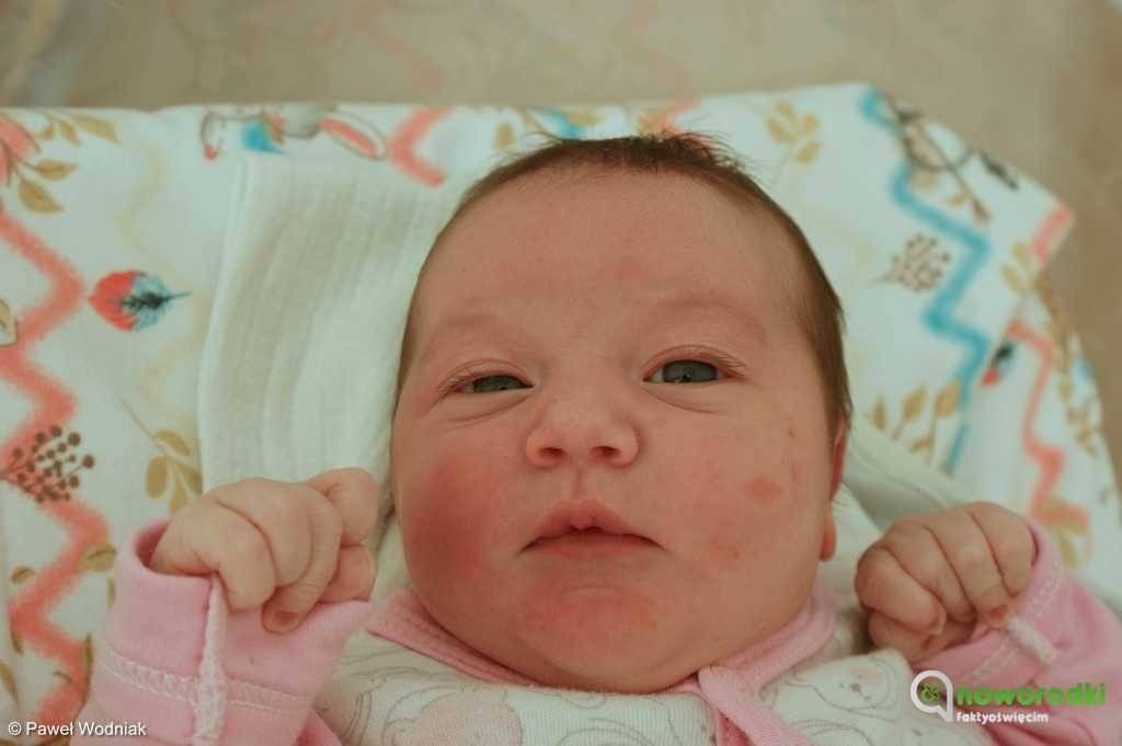 Noworodkowa galeria eFO – FOTO