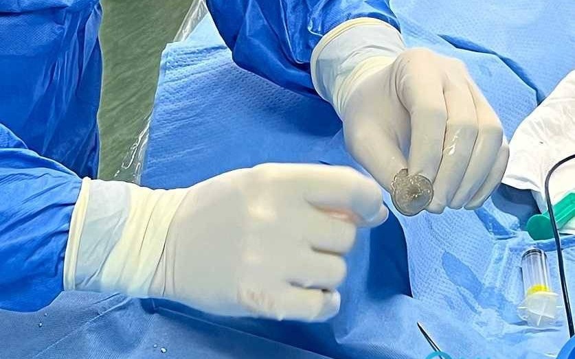 Diagnostyka i zamykanie PFO w Carincie – FILM