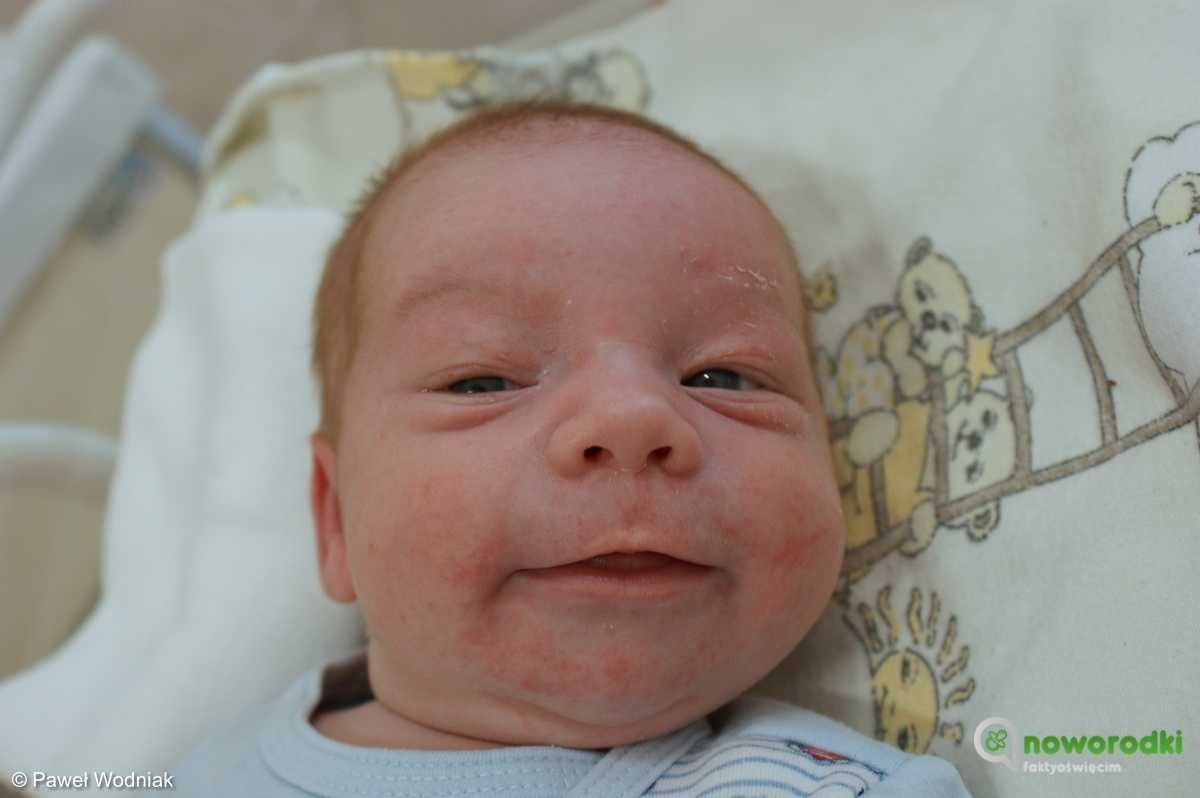 Noworodkowa galeria eFO – FOTO