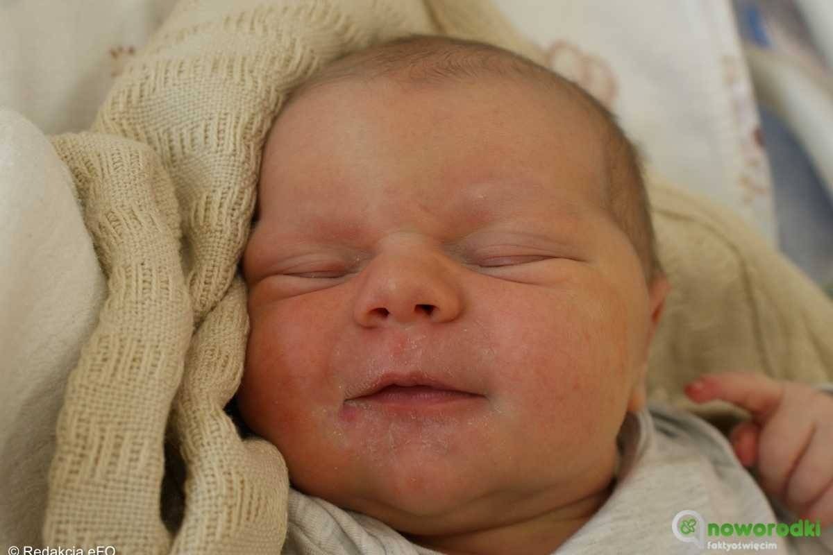 Noworodkowa galeria eFO – FOTO