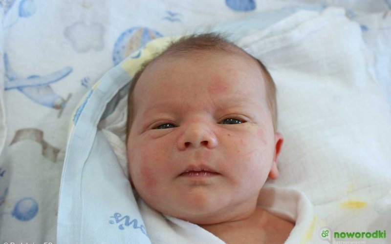 Noworodkowa galeria eFO – FOTO