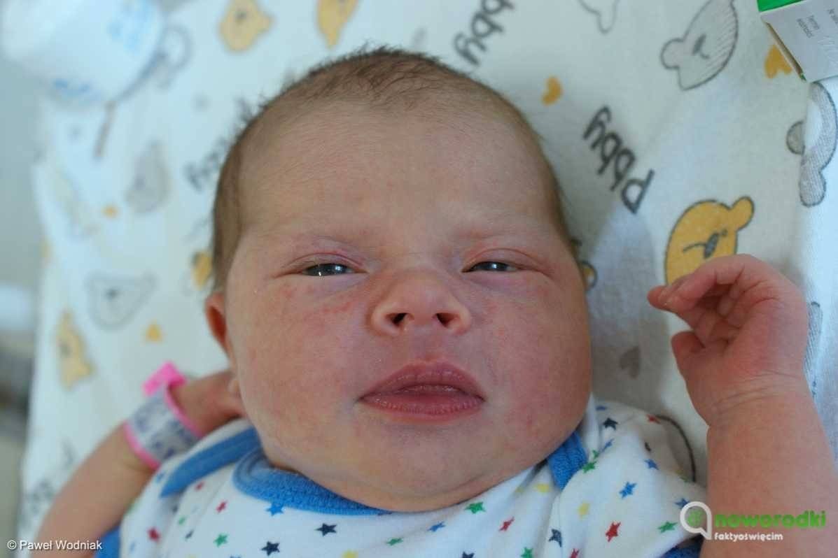 Noworodkowa galeria eFO – FOTO