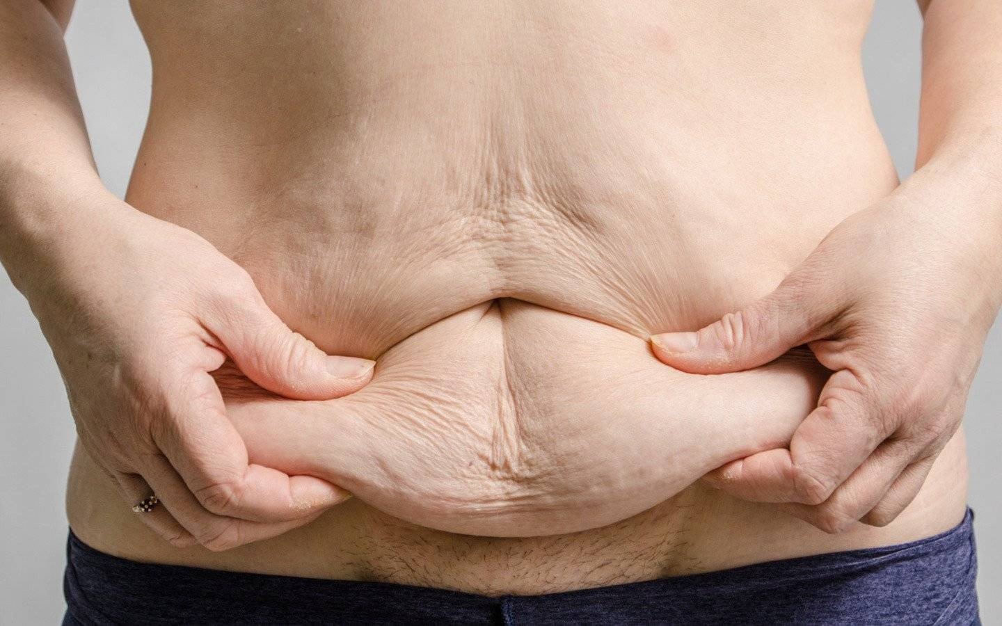 Jak poradzić sobie z luźną skórą po schudnięciu? – FILM