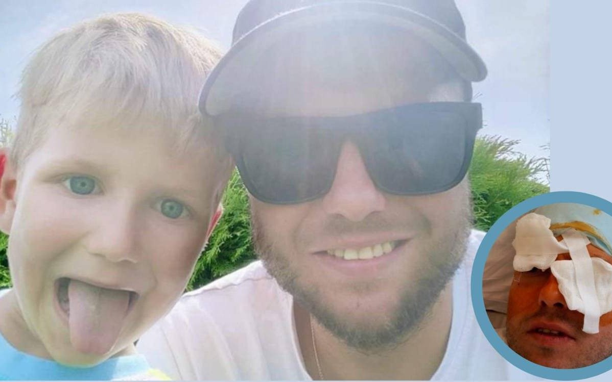 Zbiórka dla Tomka Kozieła. Potrzebne wsparcie na kosztowne operacje