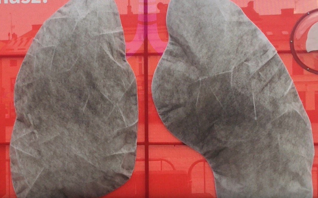 OŚWIĘCIM. „Płuca” po 14 dniach były czarne od smogu