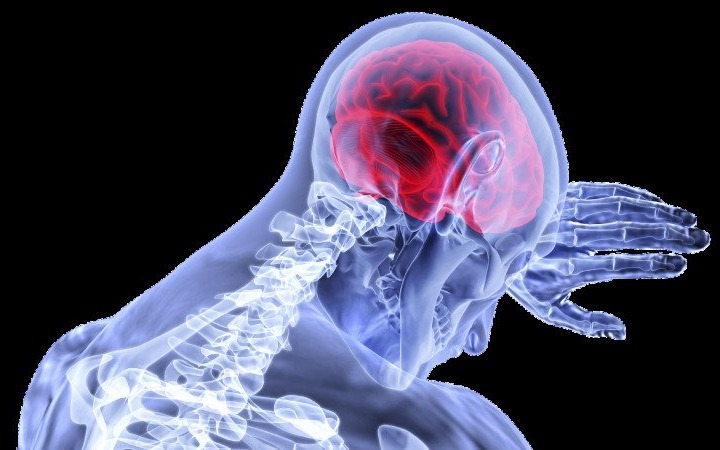 Jak ustrzec się udaru mózgu? Skorzystaj z bezpłatnych i bezbolesnych badań sfinansowanych przez Powiat Oświęcimski