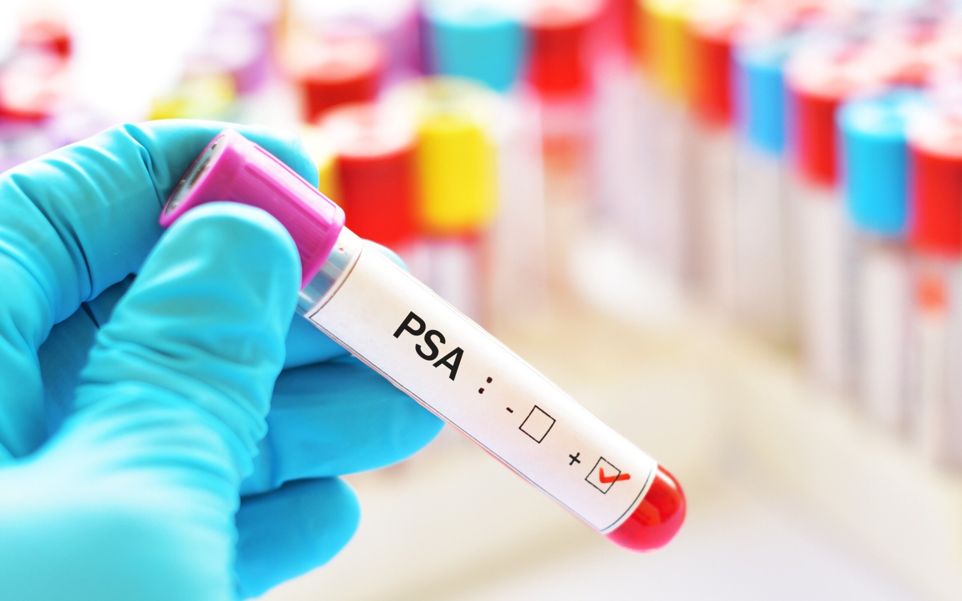 PSA – test dla mężczyzny. Bezpłatne badania profilaktyczne w Szpitalu Powiatowym w Oświęcimiu