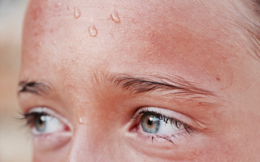 Jakie są przyczyny nadmiernego pocenia się?