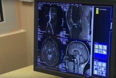 Otwarcie pracowni rezonansu magnetycznego przez premier RP Beatę Szydło (WIDEO)