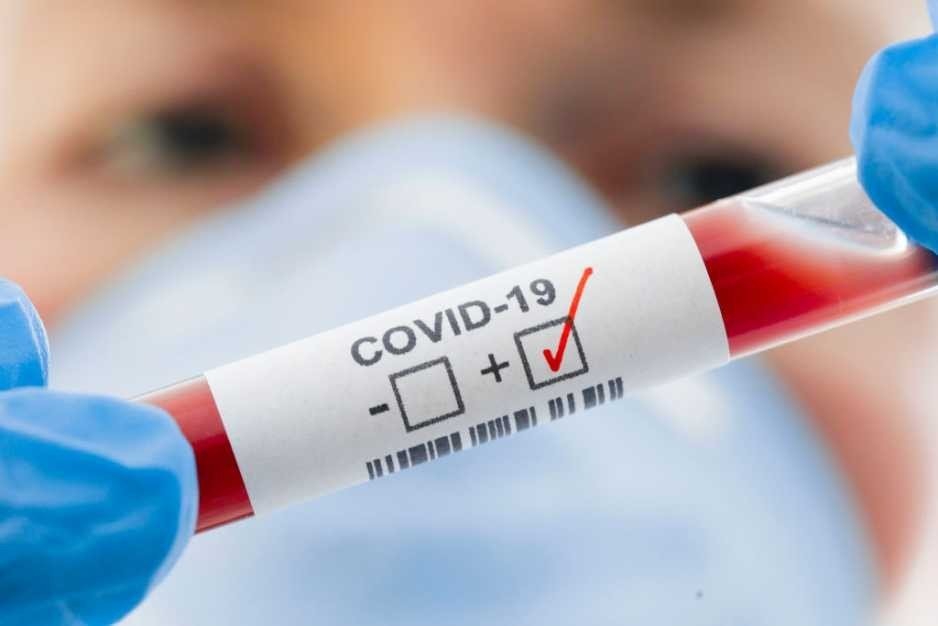 Powiat oświęcimski w ,,żółtej" strefie zagrożenia COVID-19 - InfoBrzeszcze.pl