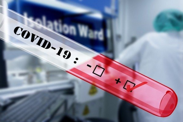 Aktualna sytuacja epidemiczna w Gminie Brzeszcze - InfoBrzeszcze.pl