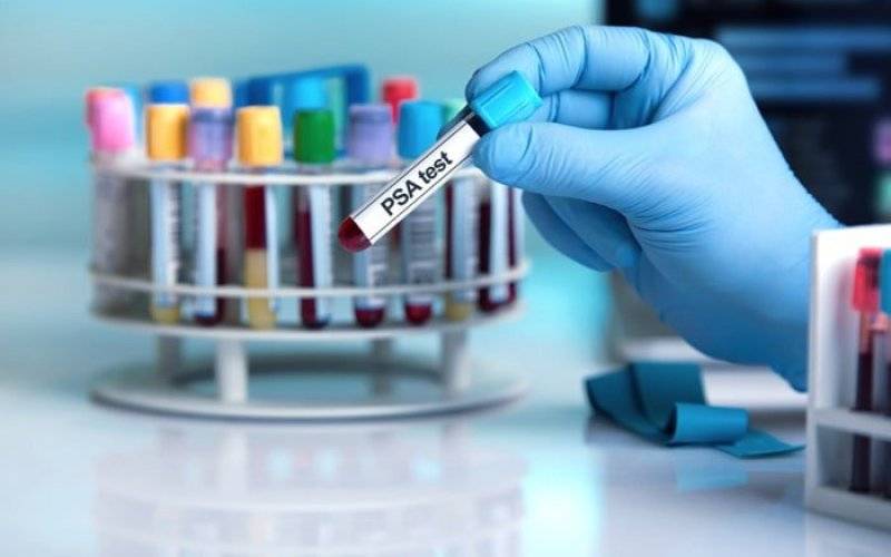 Darmowy test "PSA" dla mężczyzn powyżej 40. roku życia - InfoBrzeszcze.pl