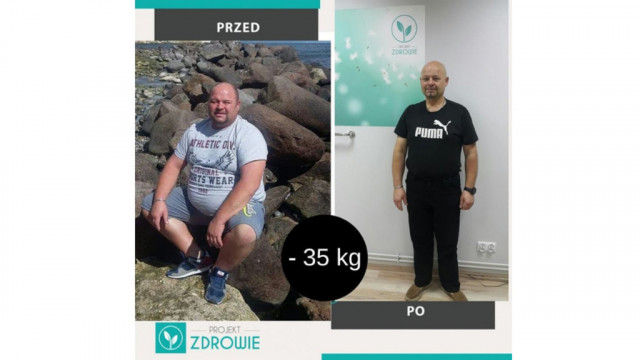 Pan Grzegorz schudł 35 kg z Projekt Zdrowie