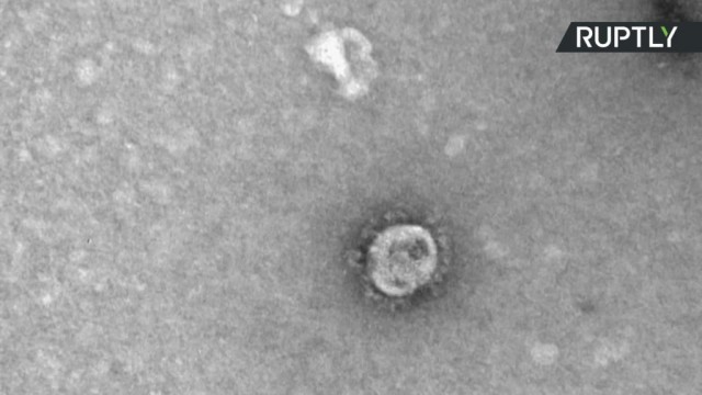 Pierwsze mikroskopowe zdjęcia koronawirusa – FILM
