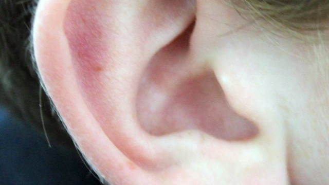 Zatkane uszy – jak sobie z nimi radzić? Najlepsze porady!